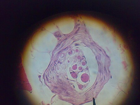 ไฟล์:Muscle_Spindle_LM_HE_stain.jpg