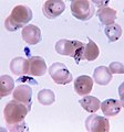 Plasmodium falciparum (Apicomplexa) u krvi