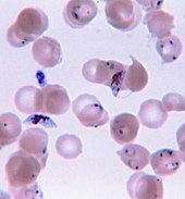 The eukaryotic parasite Plasmodium falciparum (spiky blue shapes), a causative agent of malaria, in human blood Plasmodium.jpg