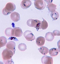 Plasmodium falciparum-gyűrűformák és gametociták emberi vérben.