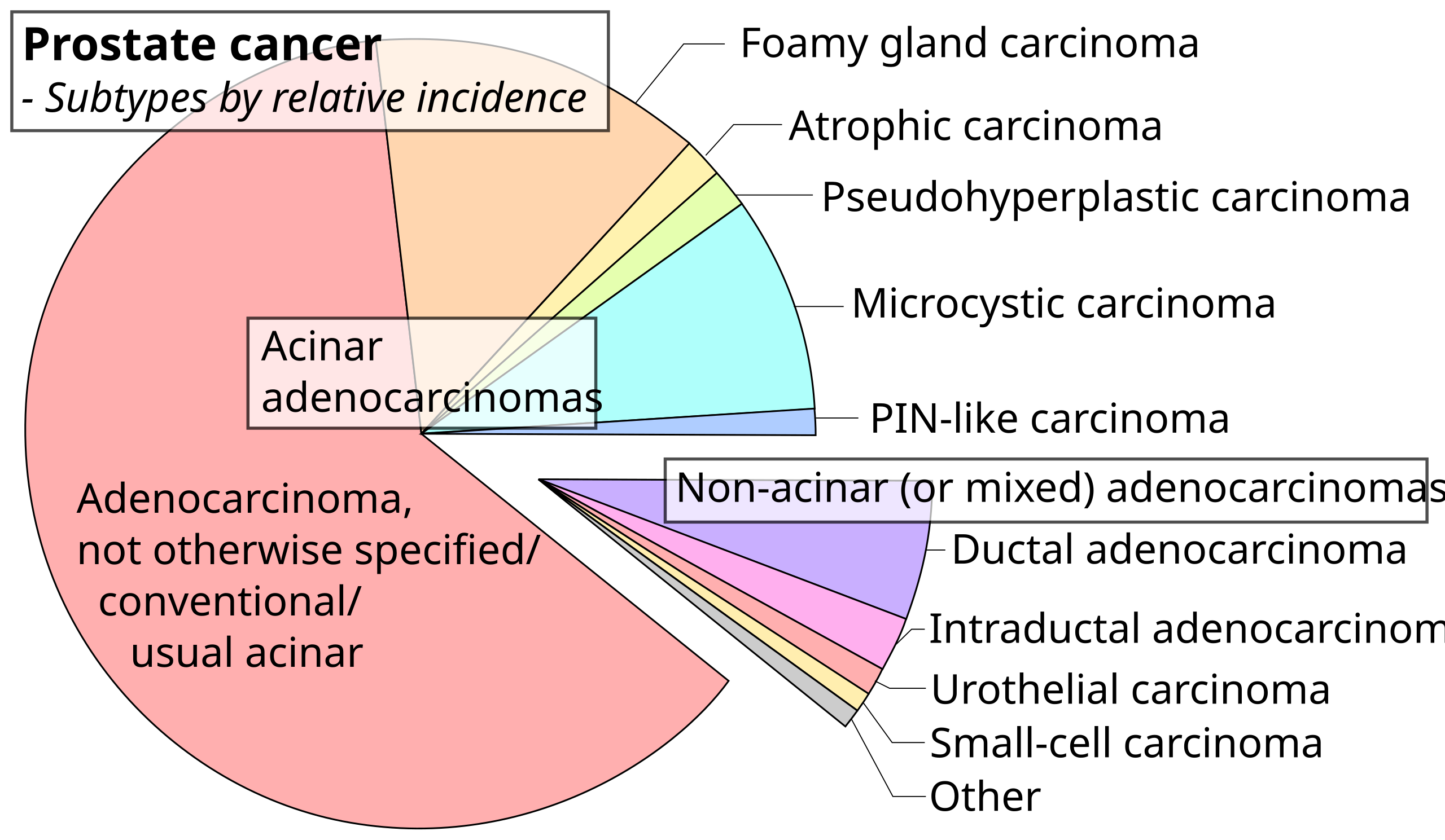 prostate cancer types of cells)