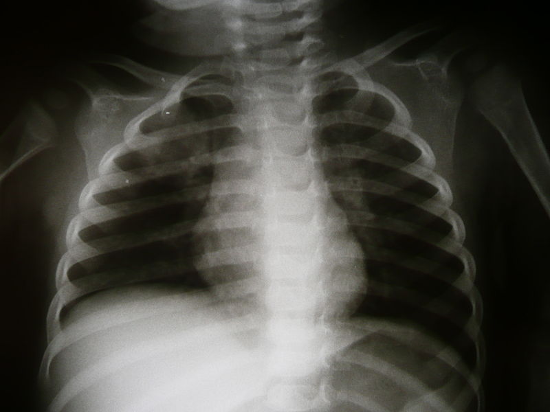 File:Radiology 1300217.JPG