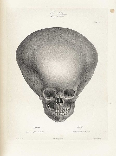 File:Vimont Traite de Phrenologie 022.jpg