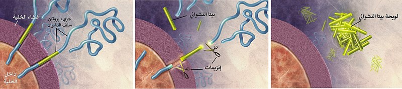 File:Amyloid-plaque formation-big-ar.jpg