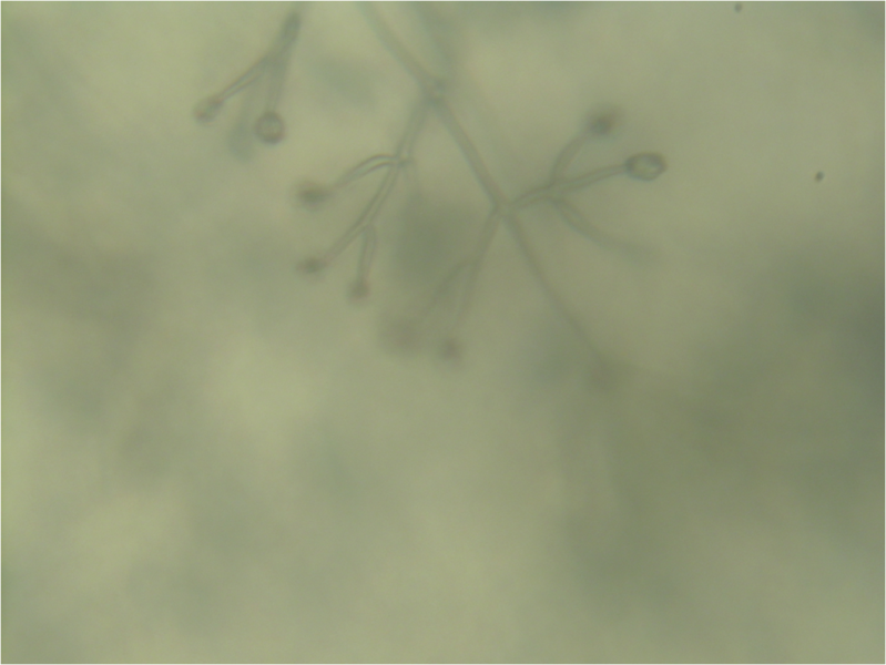 File:Dactylium spores 160X (2).png