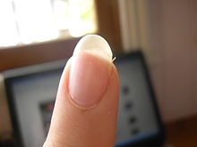 Hangnail on left index finger.jpg