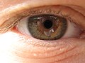 My friend Colin's right eye. Nice, eh?