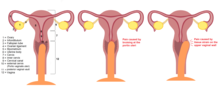 Human female inner genitalia 2.png