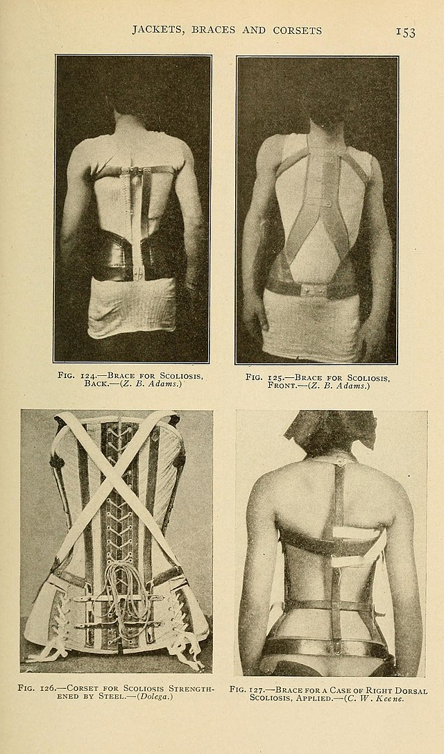 Lateral curvature of the spine and round shoulders . will sometimesshow a  slight tendency to curve to the right in the dorsal region, which  FUNCTIONAL SCOLIOSIS. SI may be due to