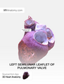 Left semilunar leaflet of pulmonary valve.png