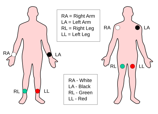 Limb leads 2 ECG