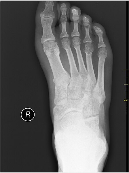 File:Medical X-Ray imaging PZO06 nevit.jpg