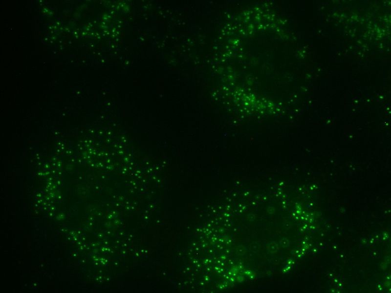 File:Peroxisome in rat neonatal cardiomyocyte.jpg