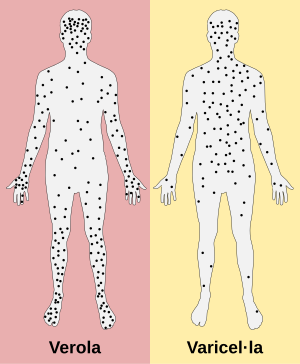 Verola: Particularitats, Causa: El virus de la verola, Evolució