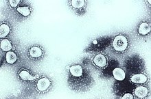 TEM of coronavirus OC43.jpg