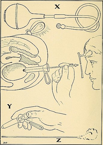 The Principles and practice of gynecology : for students and