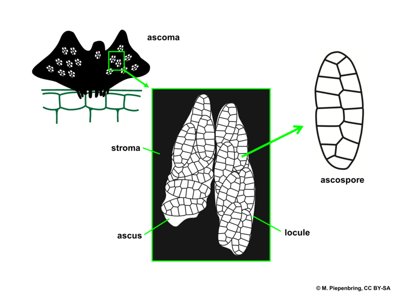 File:04 03 50 fruiting body, ascus, ascospore, Myriangium sp., Myriangiales, Ascomycota (M. Piepenbring).png