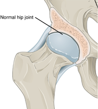 Annotated illustration of healthy hip joint