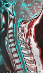 Coluna cervical 125153 rgbca 67m.png