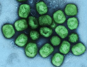 Colorized transmission electron micrograph of monkeypox virus particles (green).jpg