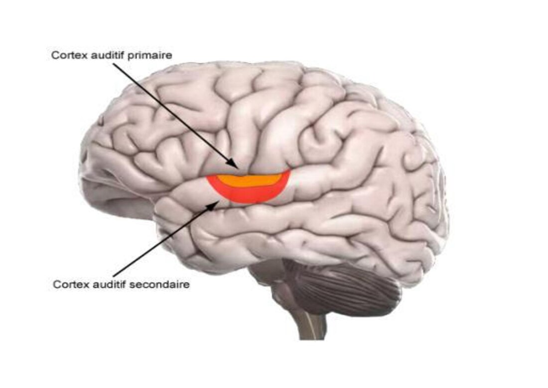 Còrtex auditiu