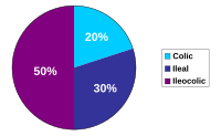 Enfermedad De Crohn: Clasificación, Etiología, Patogenia