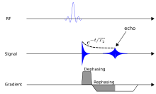 An example of non-contrast 3D turbo fi eld echo T1-weighted sequence of