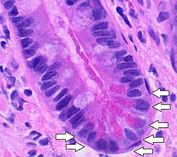 Histologi af panethceller, annoteret.jpg