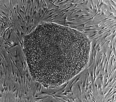 Human embryonic stem cell colony on mouse embryonic fibroblast feeder layer