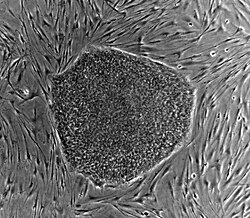 Human embryonic stem cell colony phase.jpg