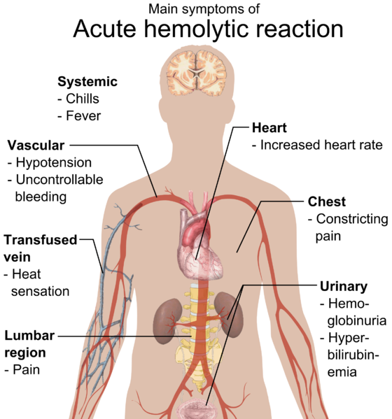 File:Main symptoms of acute hemolytic reaction.png