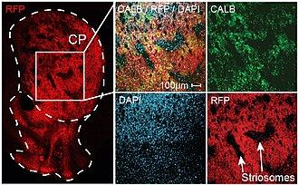 Matrix and Striosome Compartments: Fluorescence microscopy image of a coronal mouse brain section, cut through the striatum (caudate putamen, CP). The matrix/striosome division is here revealed by dual immunohistochemical (calbindin, CALB; green) and transgenic (red fluorescent protein, RFP; red) labeling of the matrix compartment, using the matrix-specific Cre-mouse line Gpr101-Cre. Unlabeled patches constitute striosomes. Matrix Striosomes mar5.jpg