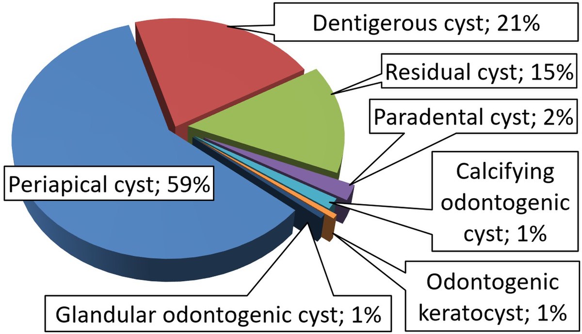 glandular odontogenic cyst