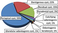 Glandular odontogenic cyst