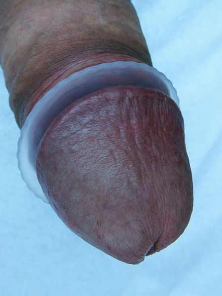 File:Silicone penis head ring.jpg