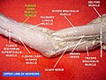 Dissecció on apareix el palmar major (flexor carpi radialis).