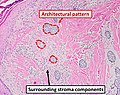 3 - Architectural pattern (in this case nests of cells)