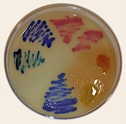 UTI agar is a chromogenic medium for differentiation of main microorganisms that cause urinary tract infections (UTIs). UTI agar.jpg