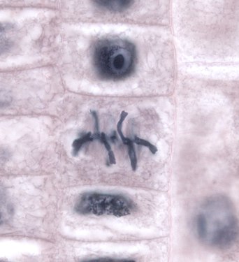 Cèl·lules de la zona del meristema de la punta de l'arrel de la ceba (Allium cepa) durant la metafase