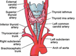 Gambar mini seharga Arteri tiroid ima