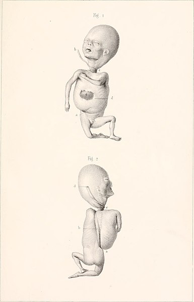 File:Comptes rendus des séances de la Société de Biologie et de ses filiales .. (1856 - 1857) (20664184722).jpg