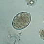 Thumbnail for File:Diphyl eggA.jpg