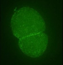 Archivo: Diverse-roles-of-actin-in-C.-elegans-early-embryogenesis-1471-213X-7-142-S9.ogv