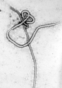 Vírus do Ébola visto por microscópio eletrônico.