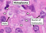Thumbnail for Histoplasma capsulatum