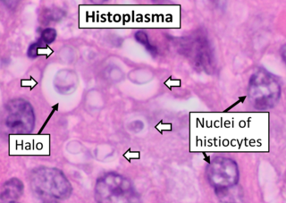 <i>Histoplasma capsulatum</i> Species of fungus