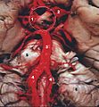 Human base of brain blood supply description.JPG