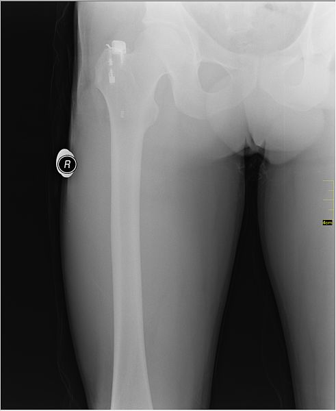 File:Medical X-Ray imaging STZ07 nevit.jpg