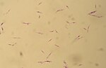 Миниатюра для Файл:Promastigotes of Leishmania tropica.jpg