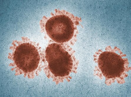 Colorized transmission electron micrograph of coronavirus 229E